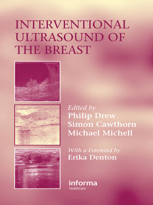 cover image of Interventional Ultrasound of the Breast